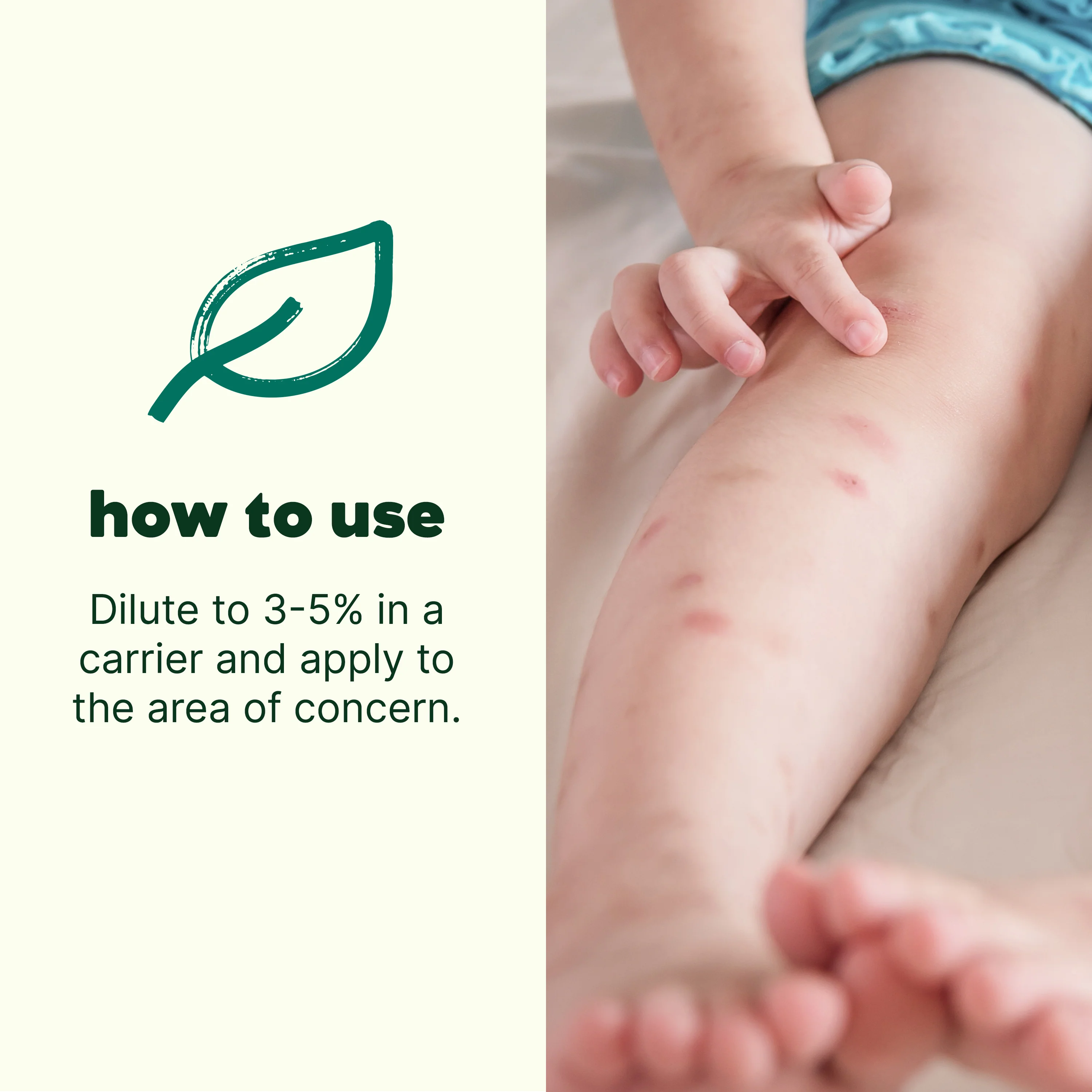 Itch Away Essential Oil - Image 3